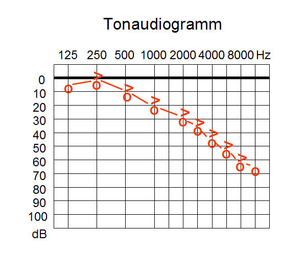 Tonaudiogramm_w_sens.jpg